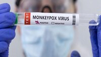 Monkeypox Virus:  मंकीपॉक्सनं वाढवली चिंता; भारतातही नवे नियम लागू
