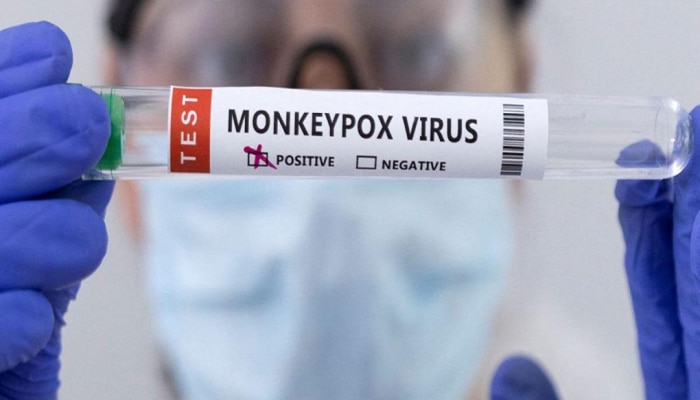 Monkeypox Virus:  मंकीपॉक्सनं वाढवली चिंता; भारतातही नवे नियम लागू, कोरोनाचेच दिवस परततायत? 