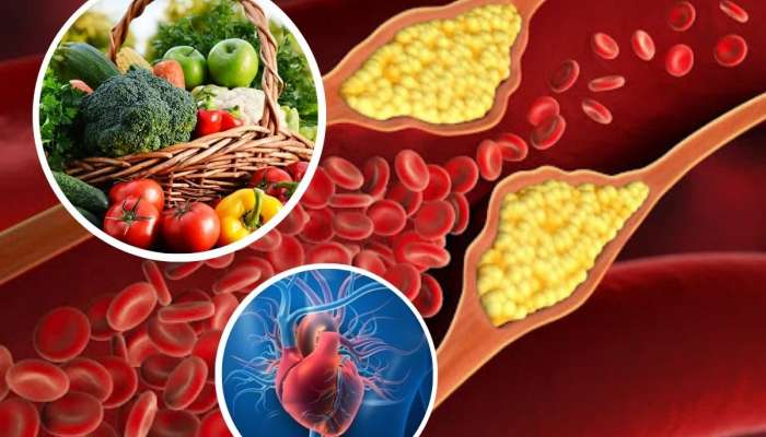 हाय कोलेस्ट्रॉलवर रामबाण ठरू शकतात &#039;या&#039; 5 भाज्या, 15 दिवस सेवन केल्यास निघून जातील नसांमधील फॅट्स