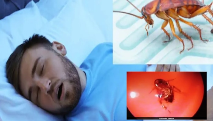 OMG! झोपेत श्वास घेताना नाकातून घशात घुसलं झुरळ; त्यानंतर जे घडलं ते अतिशय भयानक...