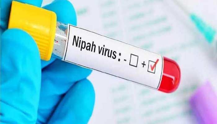 आधी मंकीपॉक्स आता Nipah Virus चा धोका, देशात 24 वर्षांच्या तरुणाचा मृत्यू... , वेळीच ही लक्षणं ओळखा?