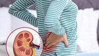 Kidney Stones च्या रुग्णांनी 'हे' 5 पदार्थ खाण्याचा स्वप्नातही विचार करु नका!