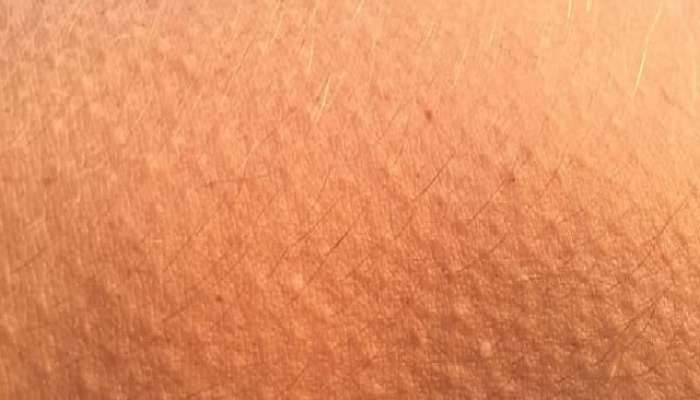 health, body, Goose Bumps, Harmons,  Goosebumps Reason, Goosebumps Causes, Goosebumps in Marathi, goosebumps Facts, Why do goosebumps arise, the reason behind goosebumps, the science behind goosebumps, is it beneficial or harmful to have goosebumps, गूजबंप्स, गूजबंप्स कारण, गूजबंप्स कारणे,  मराठीत गूजबंप्स, गूजबंप्स तथ्ये, गूजबंप्स का उद्भवतात, गूजबंप्सचे कारण, गूजबंप्समागील विज्ञान, गूजबंप्स असणे फायदेशीर आहे की हानिकारक, Marathi News, Latest News in Marathi, Marathi News Today, Maharashtra News, marathi B