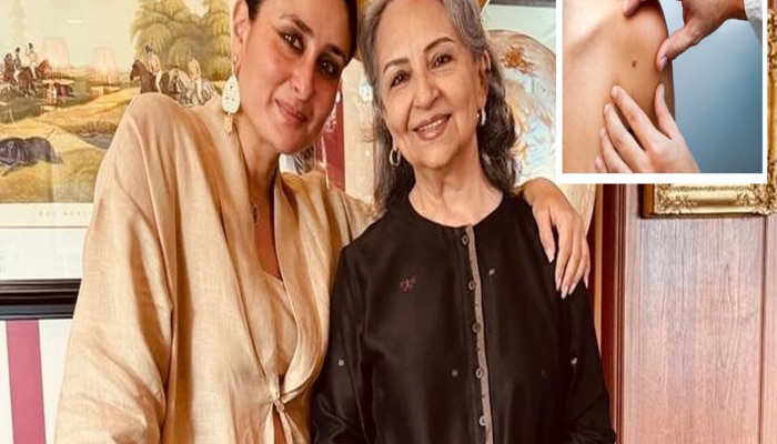 करीना कपूरची सासू शर्मिला टागोर यांनी दिली कॅन्सरशी झुंज; शरीरातील कर्करोगाचे पहिलं लक्षण कोणते?