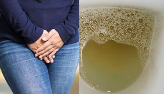 foam in your urine A symptom kidney Failure Diabetes dehydration Health Marathi News 