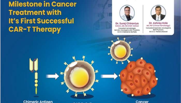 M | O | C कॅन्सर केअर आणि रिसर्च सेंटरने कॅन्सर उपचारात गाठला नवा मैलाचा दगड, पहिल्या यशस्वी CAR-T थेरपीची उपलब्धी