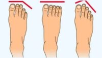 Personality Test: पायाचा अंगठा सांगतो तुमचं व्यक्तिमत्व आणि स्वभाव, एकदा खात्री करुन