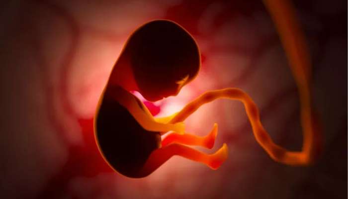 Fetus in Fetu : पोटात गर्भ घेऊनच जन्माला आलं मुलं; आज होणार शस्त्रक्रिया, राज्यातील पहिली घटना 