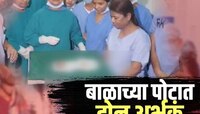 महाराष्ट्रातील डॉक्टरांचा चमत्कार!  3 दिवसांच्या बाळाच्या पोटातून काढली 2 बाळं, 