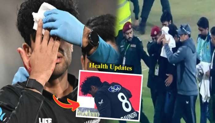 'नेमका त्याच्या कपाळावरच...' रचिन रवींद्रची दुखापत किती गंभीर? न्यूझीलंड क्रिकेटने दिले अपडेट्स, IPL ला मुकणार?