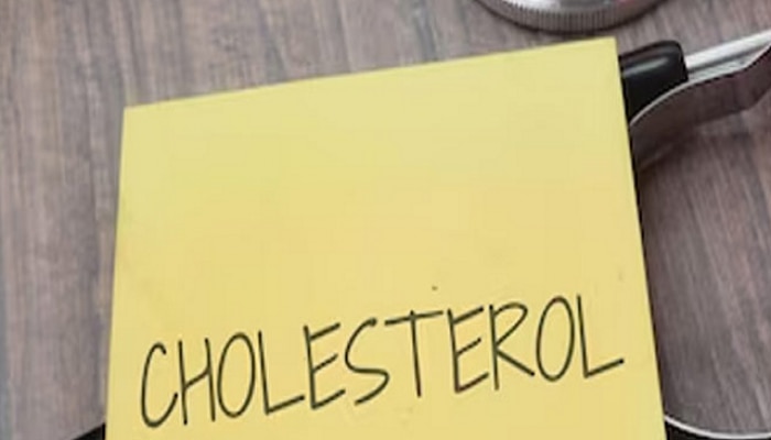 cholesterol, human heart, human body, cholesterol level, normal human cholesterol level, good cholesterol, bad cholesterol, heart stroke, heart problems, कोलेस्ट्रॉल, आरोग्य, आरोग्य बातम्या, मराठी बातम्या 