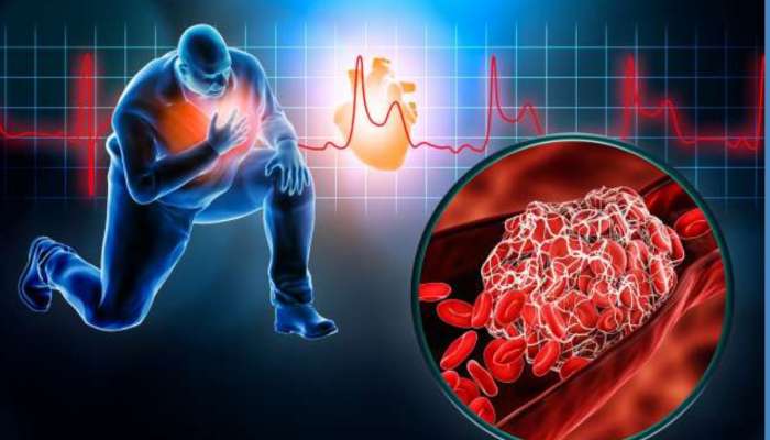हार्ट ब्लॉकेज होताच शरीरात दिसतात 5 लक्षणे; लवकरच Heart Attack ची शक्यता