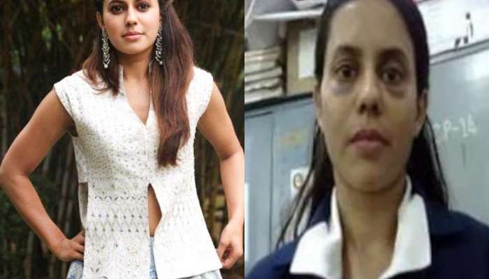 सुजलेला चेहरा, काळे डाग! अभिनेत्री रन्या रावला कस्टडीत मारहाण? व्हायरल फोटोवर महिला समितीने केलं भाष्य