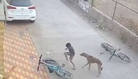 चिमुकल्यावर कुत्र्याचा हल्ला, हात, खांदा, मानेचे लचके तोडले
