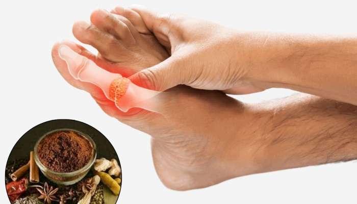 Uric Acid झपाट्याने कमी करेल 'हा' मसाला; फक्त वापरायचं कसं हे समजून घ्या 