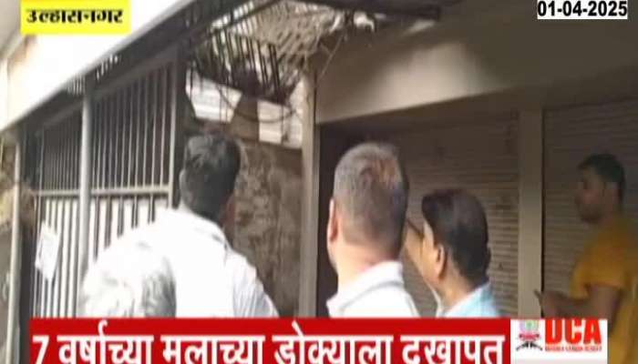 Ulhasnagar Two Children Injured After Grill Breaks Out From second floor 