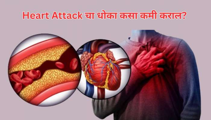 हृदयातील 70% ब्लॉकेजला रिवर्स करतील खालील उपाय, कोलेस्ट्रॉलही राहील कंट्रोलमध्ये हृदयातील 70% ब्लॉकेजला रिवर्स करतील खालील उपाय, कोलेस्ट्रॉलही राहील कंट्रोलमध्ये