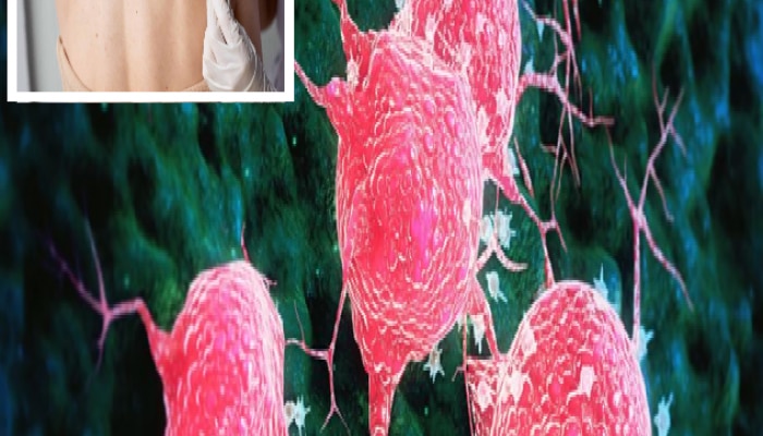 Cancer पसरल्यावर शरीरात काय लक्षणं दिसतात?