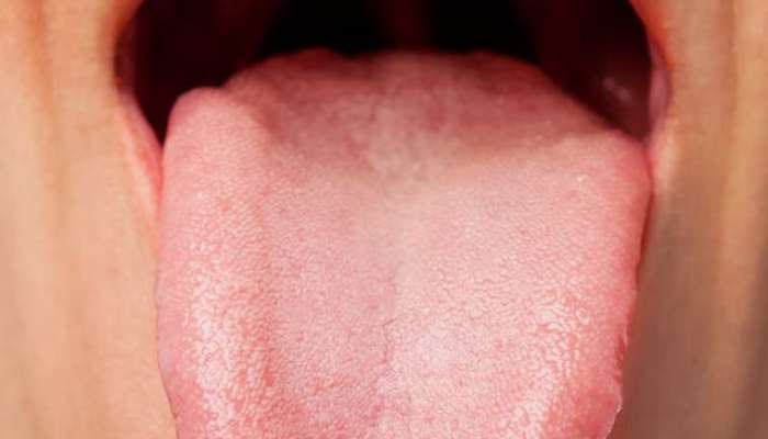 bad breath causes, black hairy tongue, daily tongue cleaning tips, digestive issues from poor oral hygiene, dry mouth and bad breath, how to clean your tongue, oral care routine, oral thrush prevention, risks of not cleaning tongue, health, health news, health news in marathi, 