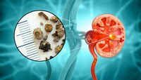 Kidney Stone च्या रुग्णांनी चुकूनही खाऊ नका 6 फळं; जीवावर बेतेल 