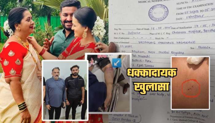 आत्महत्येआधी वैष्णवीच्या शरीरावर...; हगवणेंच्या क्रूरपणाचा कळस; Post Mortem मधून खुलासा