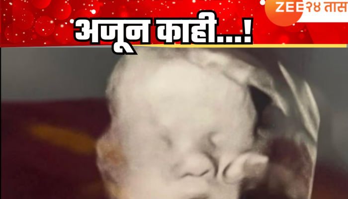 Viral News : गर्भाशयातील आजारी बाळाची काळजी घेताना दिसला देव? अल्ट्रासाऊंड पाहून संपूर्ण कुटुंब भावुक; काय आहे नेमकं प्रकरण?