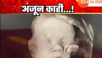 Viral News : गर्भाशयातील आजारी बाळाची काळजी घेताना दिसला देव? अल्ट्रासाऊंड पाहून संप