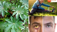 100 वर्ष सुदृढ जगायचंय? कावीळ, यकृताच्या समस्या कायमच्या दूर करायच्यात मग आवर्जून खा