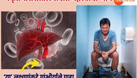 सकाळी उठताच टॉयलेटमध्ये 'ही' लक्षणे दिसली तर समजा लिवर सडतंय? अजिबात इग्नोर करु नका?