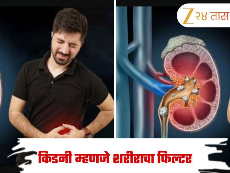 सावधान! 'या' 10 गोष्टी खाल्ल्या की किडनीमध्ये तयार होतात मूतखडे, वेळीच थांबवा नाहीतर ऑपरेशन अटळ