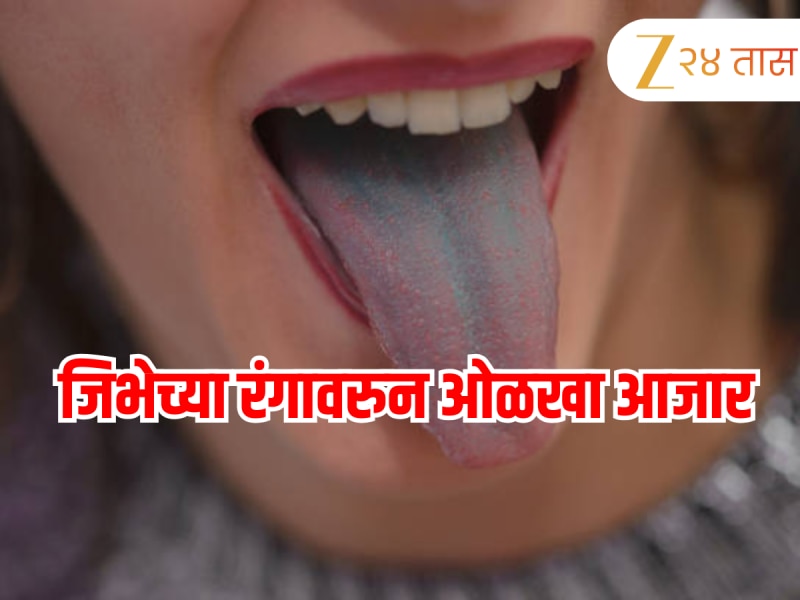 जीभेच्या रंगावरुन ओळखा तुमचे आजार? 'या' पद्धतीचे संकेत खतरनाक