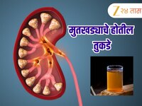 किडनीत झालेल्या मुतखड्याचा भुगा करेल 'हे' पाणी; फक्त सेवन करताना विशेष काळजी घ्या