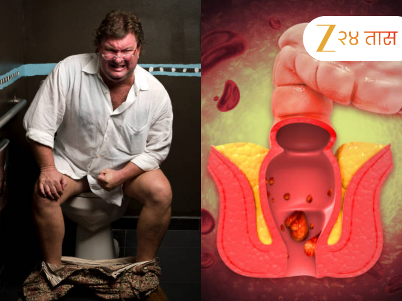 बद्धकोष्ठतेचाच त्रास होतोय, हे कसं ओळखाल? डॉक्टरांनी सांगितलं Constipation झाल्यास दिसतात 'ही' लक्षणं 