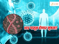 AIDS वर डॉक्टरांनी मिळवला विजय, रोजच्या औषधांपासून कायमची सुटका
