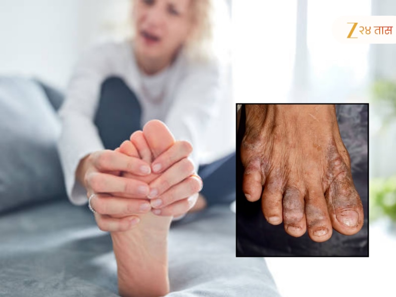 पायात दिसतील Silent Killer ची ६ लक्षणे, लोकांना वाटतं हा थकवा पण ...