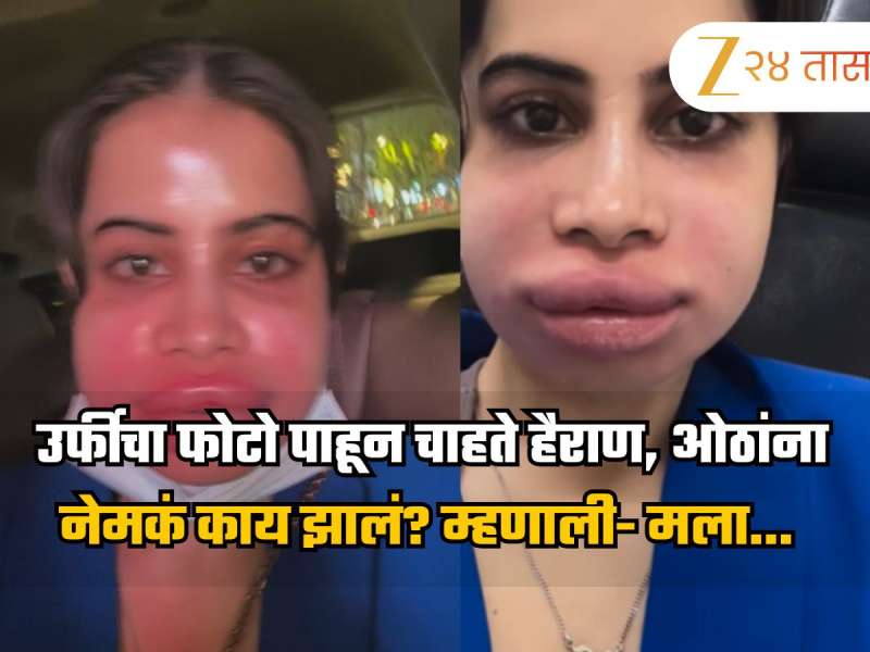 उर्फीचा फोटो पाहून चाहते हैराण, ओठांना नेमकं काय झालं? म्हणाली- मला... 