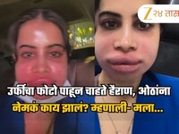 उर्फीचा फोटो पाहून चाहते हैराण, ओठांना नेमकं काय झालं? म्हणाली- मला... 