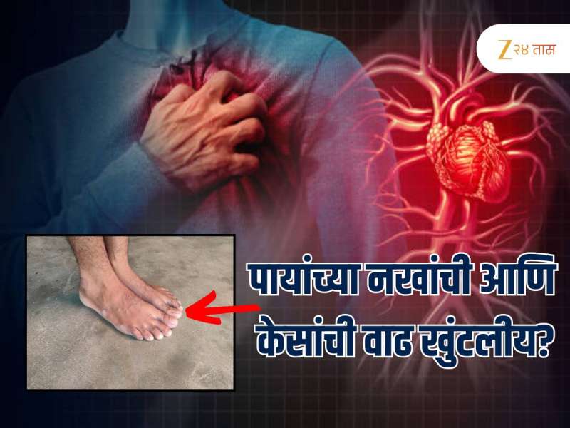 90% लोकांना माहित नाही, नखं आणि पायाच्या केसांची कमी वाढ हे हार्ट ब्लॉकेजचं लक्षणं, डॉक्टरांनी काय म्हटलं पाहा