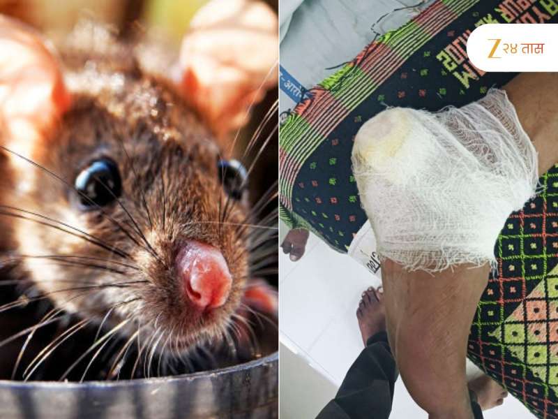 ऑपरेशनआधीच उंदराने कुरतडला पाय; सरकारी रुग्णालयातील धक्कादायक प्रकार