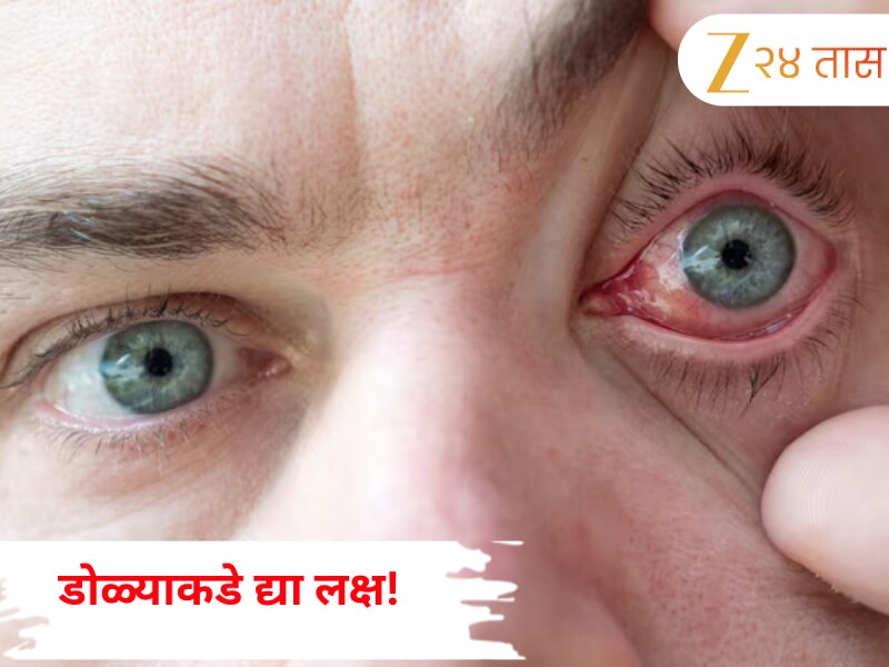 Eye Care: डोळ्याकडे द्या लक्ष! रेटिना आजाराच्या 'या' सात लक्षणांकडे करू नका दुर्लक्ष 