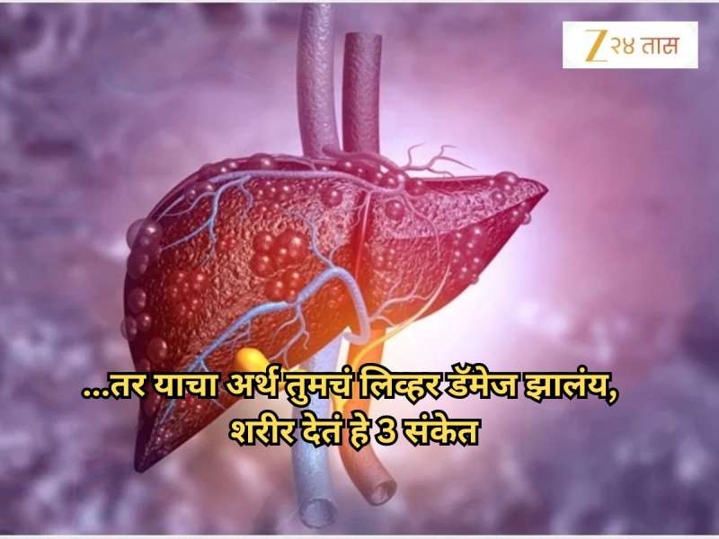 ...तर याचा अर्थ तुमचं लिव्हर डॅमेज झालंय, शरीर देतं हे तीन संकेत; दुर्लक्ष केल्यास आयुष्यभर होईल पश्चात्ताप