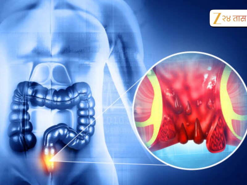Colon cleansing remedies : बद्धकोष्ठतेचा जुना त्रास, आतड्यांमधील मल खेचून बाहेर काढेल प्रेमानंद महाराजांचा 'हा' उपाय 