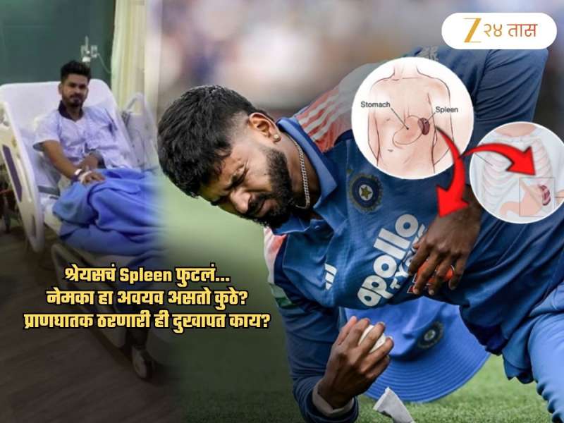 श्रेयसच्या पोटात Spleen फुटलं... प्राणघातक दुखापत... हा अवयव काय काम करतो? तो फुटल्यास...