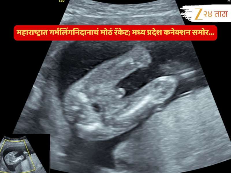 चाललंय काय? महाराष्ट्रात गर्भलिंगनिदानाचं मोठं रॅकेट उघड; मध्य प्रदेश कनेक्शन समोर..