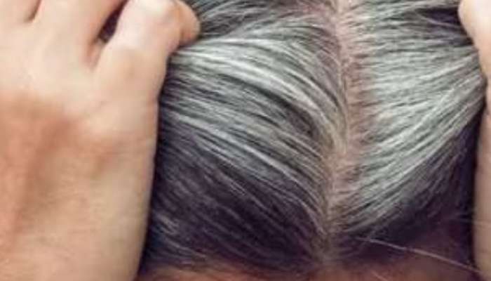 White Hair, Reason For Premature White Hair Problem, Reason For White Hair Problem, Solution For Premature White Hair Problem, Foods For Premature White Hair Problem, White Hair Remedies, hormonal imbalance, Pollution, Tension, Stress, Smoking, Vitamin B For Premature White Hair, Vitamin B For White Hair, Hair Care Tips, Benefits Of Garlic, Benefits Of Garlic For Hair, Problem Of White Hair, Problem Of Falling Hair, How To Make Hair Silky, How To Apply Flaxseed, Benefits Of Flaxseed Gel, Solution To Hair Pr