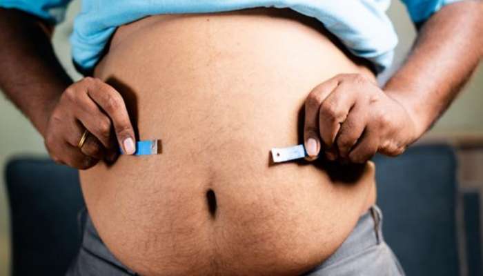 Obesity Curve :  जगभरात 1 अब्जाहून लोक लठ्ठ, द लॅन्सेटच्या अहवालानुसार भारताची आकडेवारी धक्कादायक